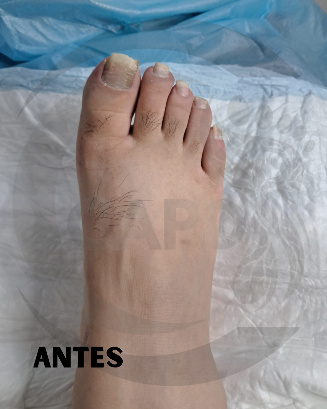 Caso 04 Antes