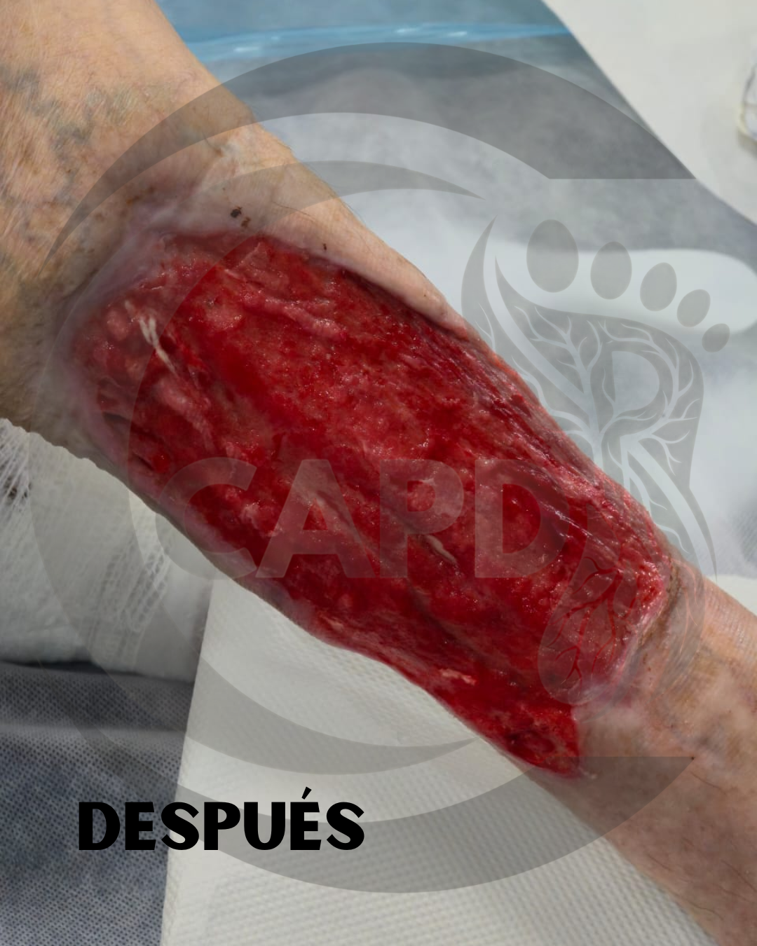 Caso 02 Despues