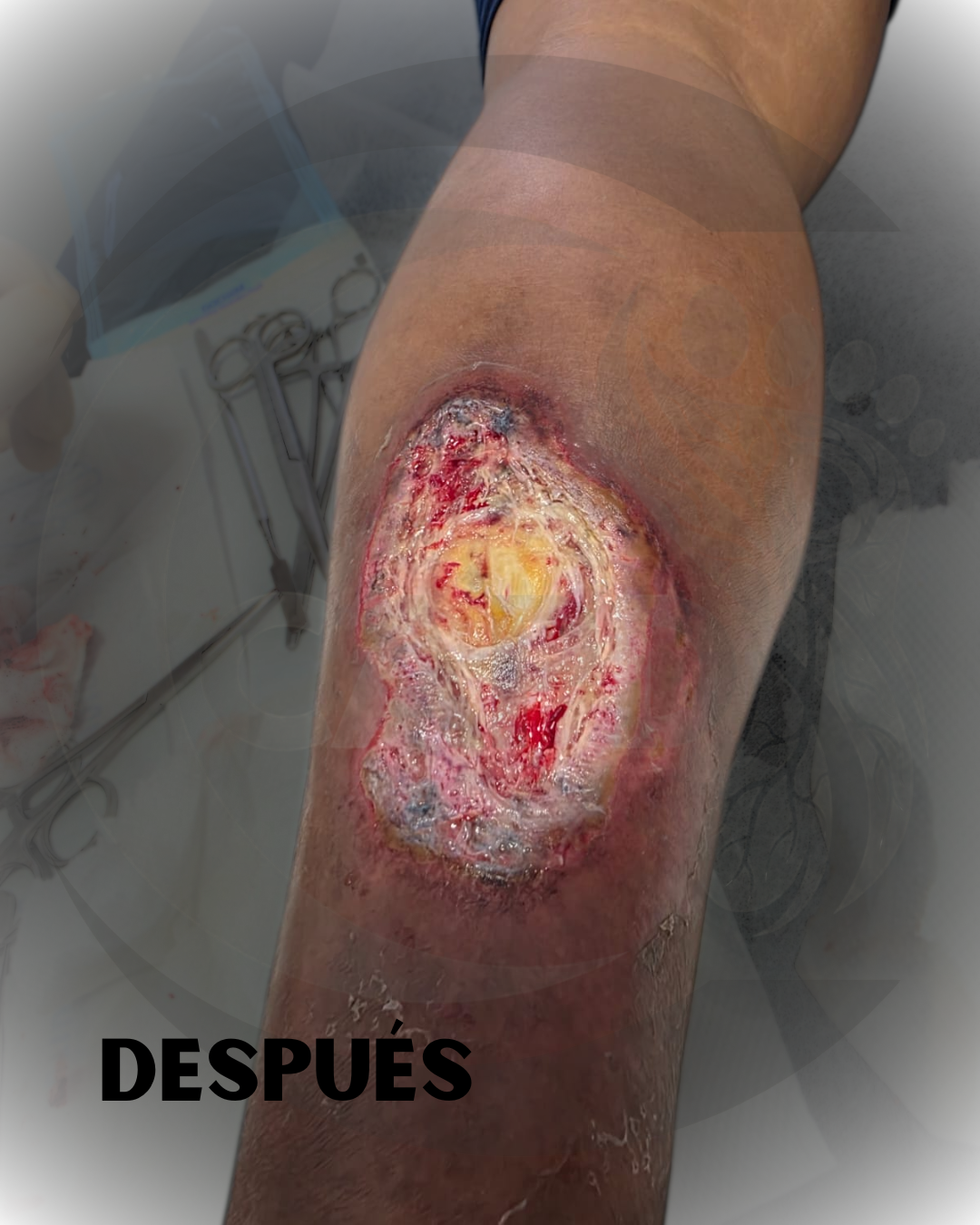 Caso 01 Despues