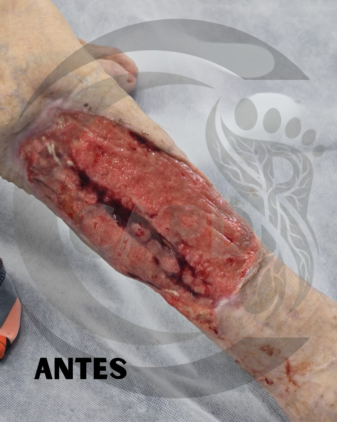 Caso 02 Antes