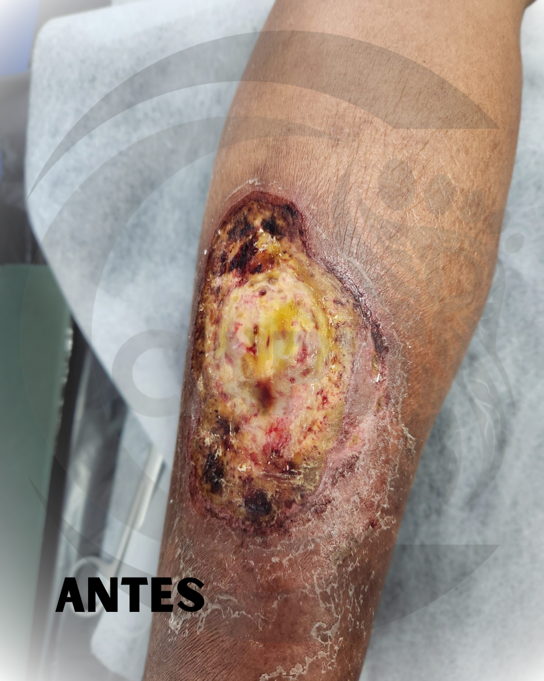 Caso 01 Antes